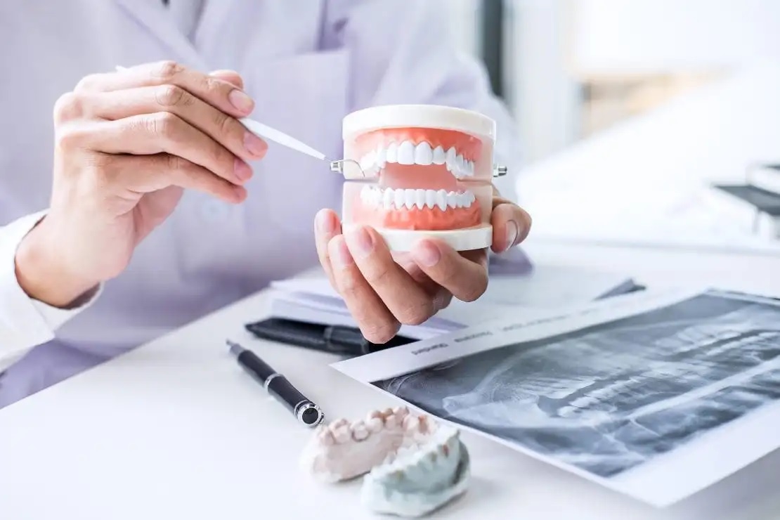 5 facts you need to know about dental implants