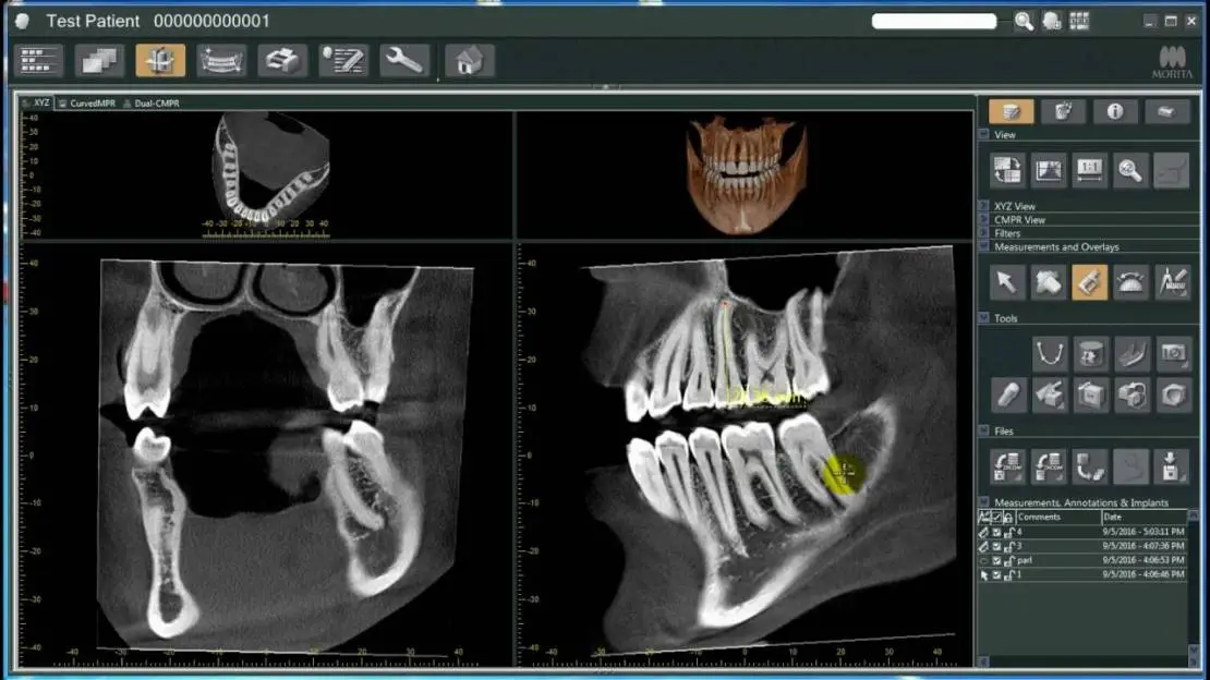 Digital X-ray north brand dental